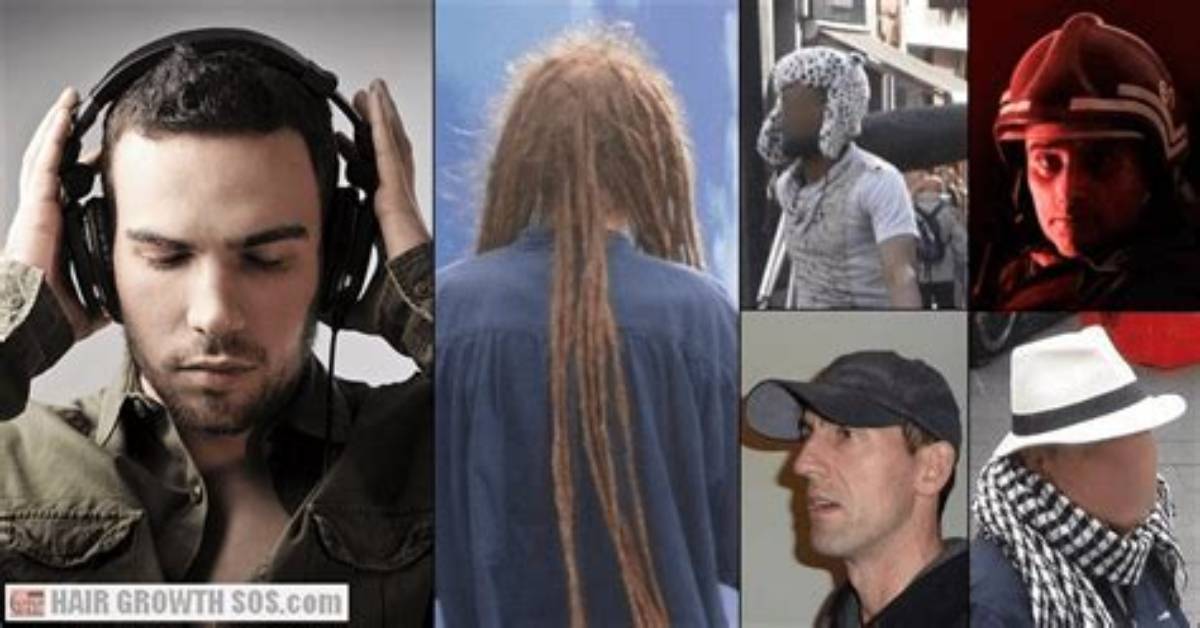 Does Dreadlocks Cause Baldness?
