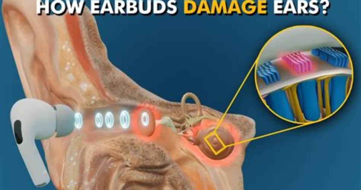 Does Earphone Damage Ear?