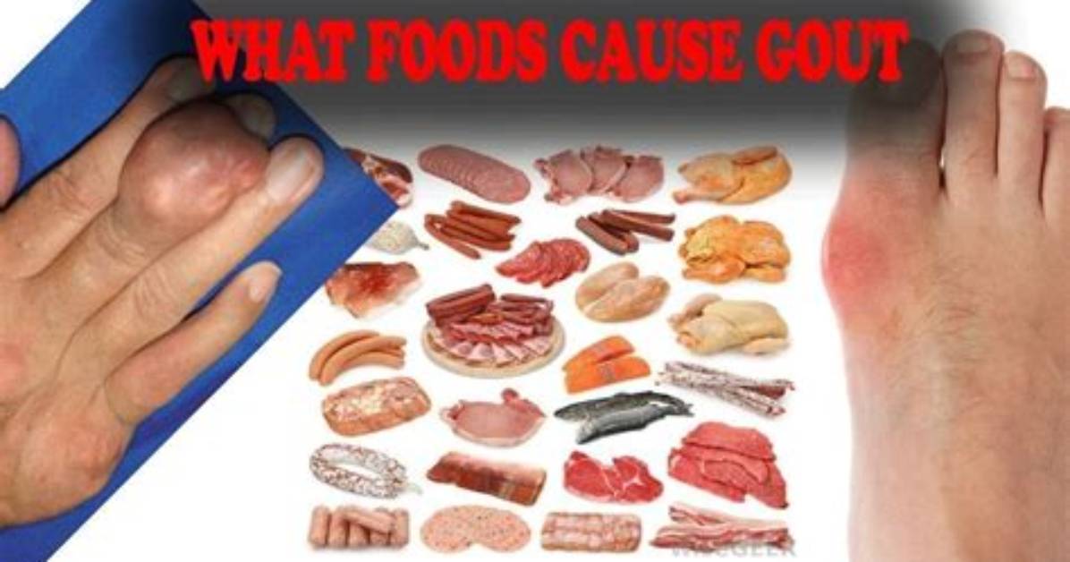 Does Eating Tripe Cause Gout?