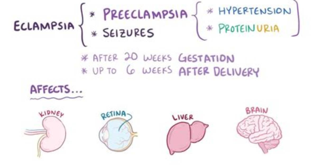 Does Eclampsia Cause Vomiting?