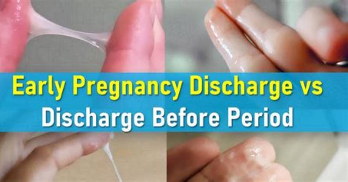 Does Effacing Cause Discharge?