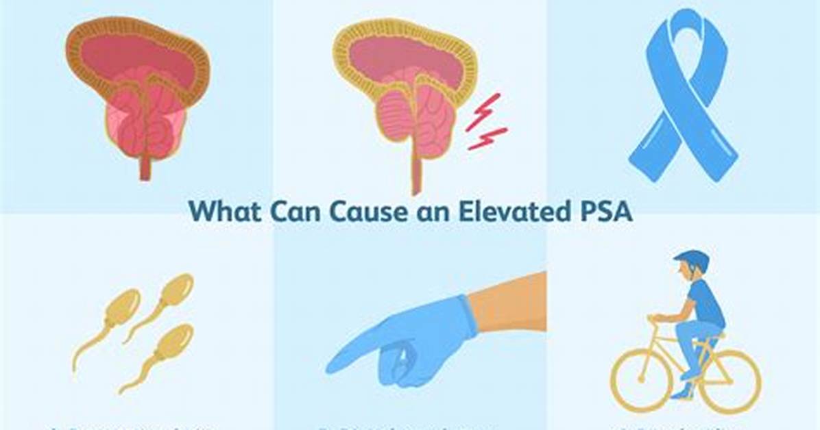 Does Ejaculation Raise Psa Levels?