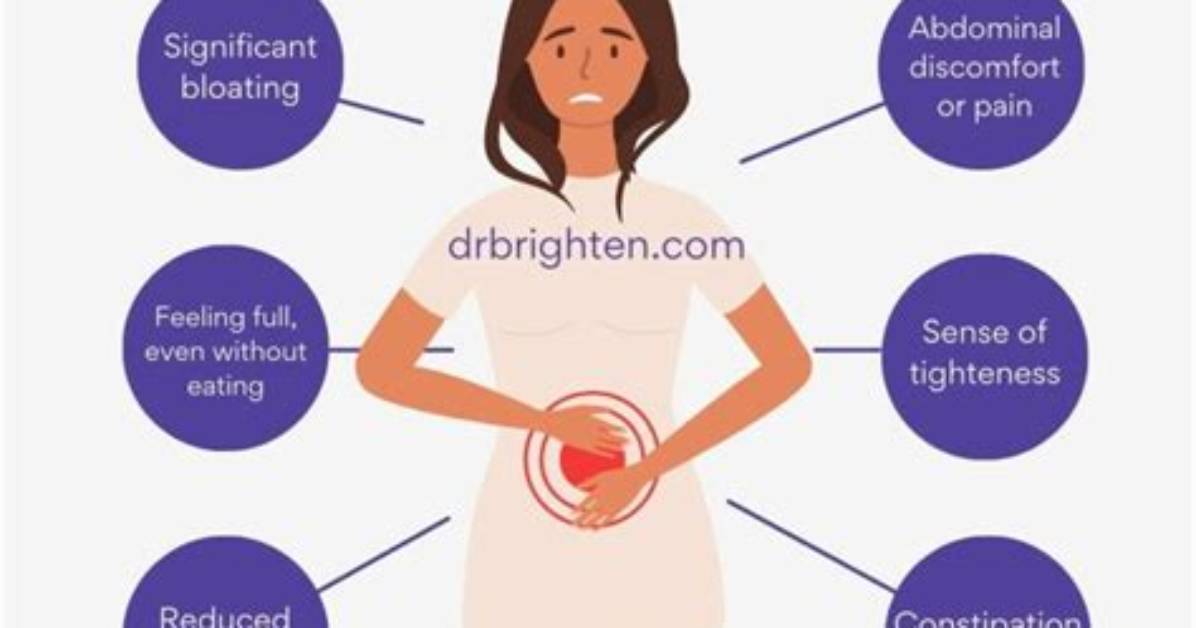 Does Endo Belly Go Away?