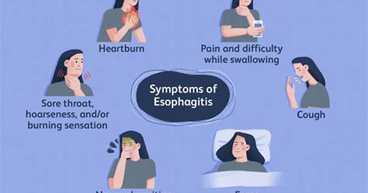 Does Esophagitis Cause Coughing?