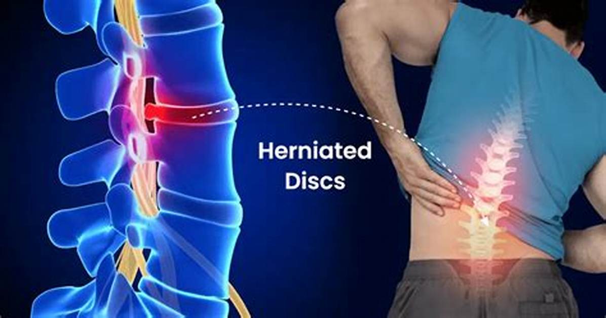 Does Extruded Disc Heal?