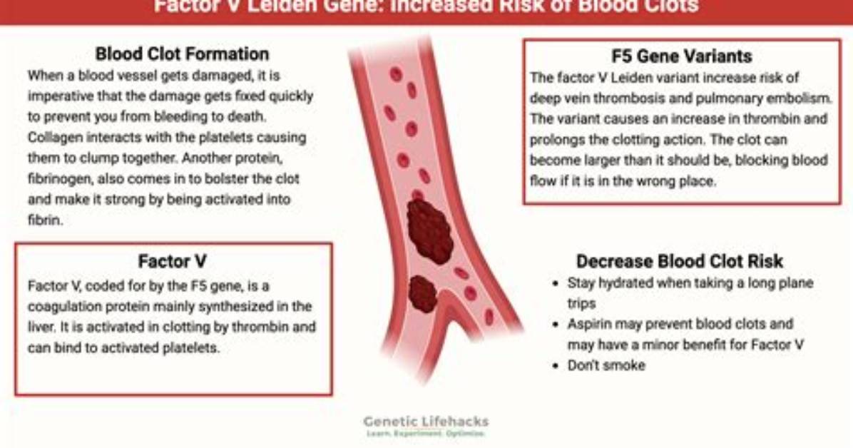 Does Factor v Leiden Skip a Generation?