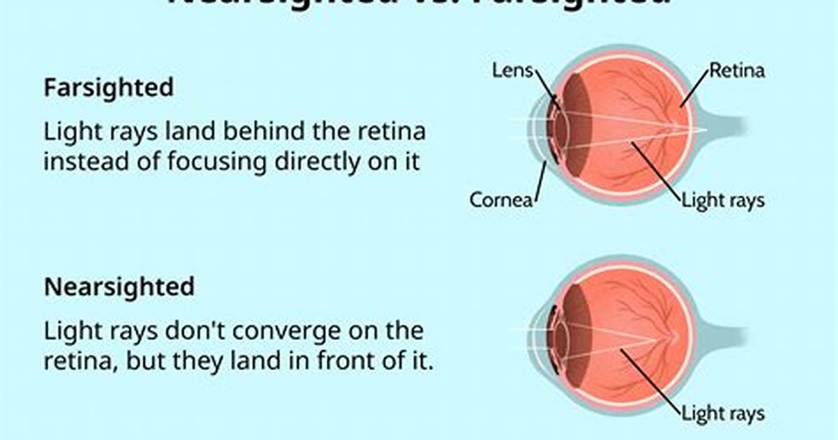 Does Far Sighted Improve with Age?