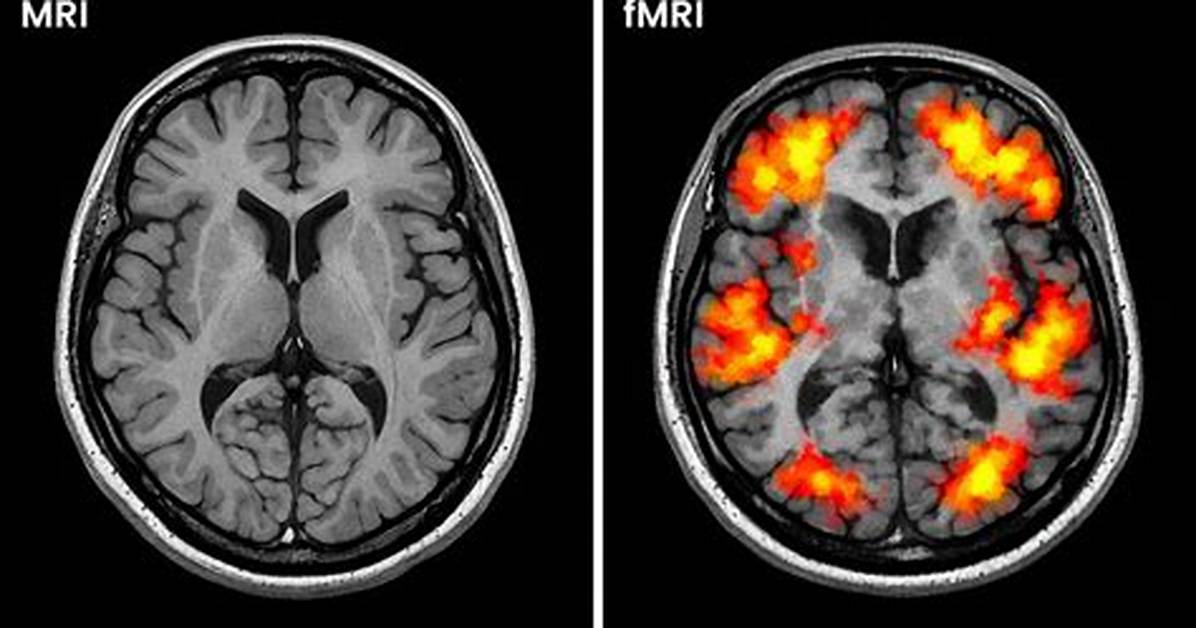 Does fMRI Use Contrast?