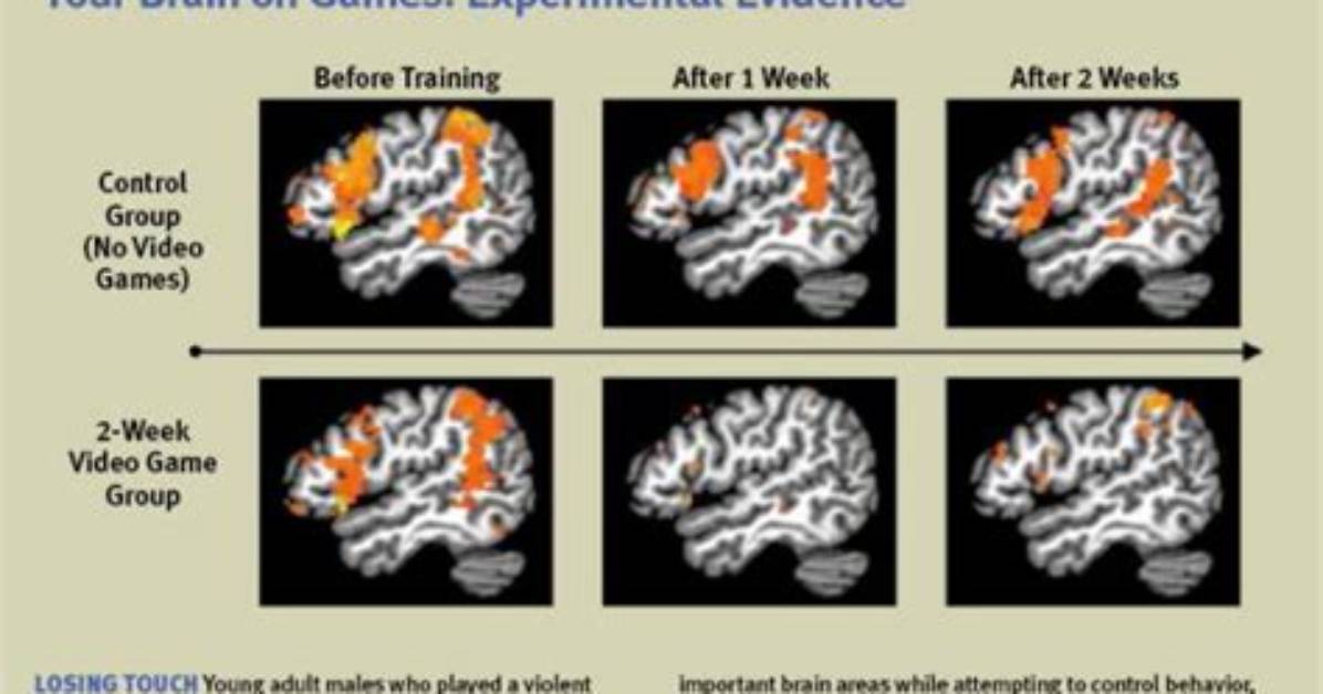 Does Gaming Affect Your Brain?