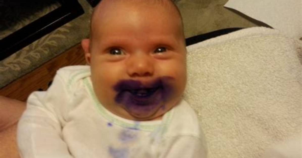 Does Gentian Violet Stain Teeth?
