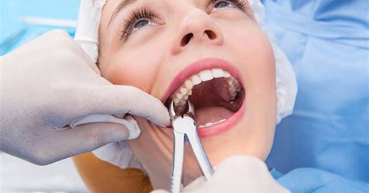 Does Getting Two Teeth Pulled Hurt?