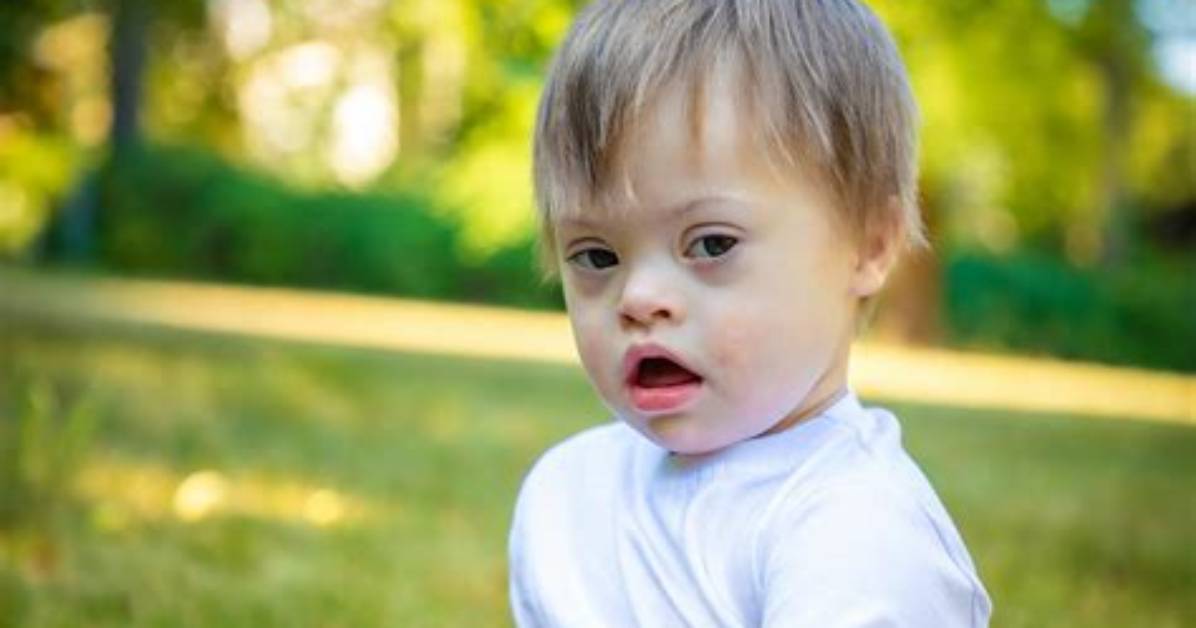 Does He Have a Down Syndrome?