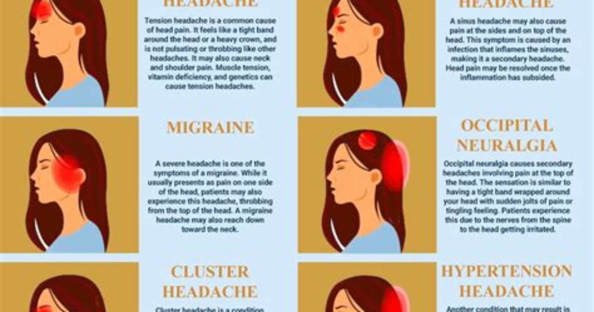 Does Headband Cause Headache?