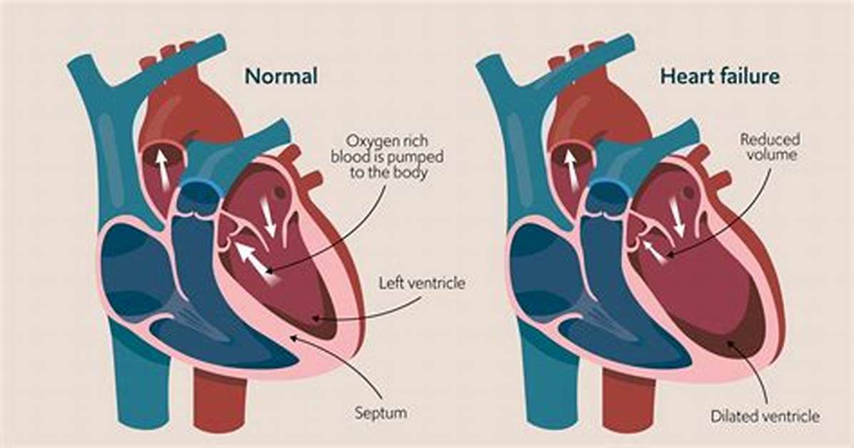 Does Heart Failure Cause Shaking?