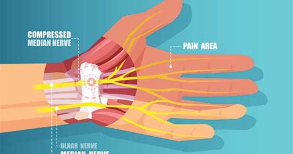 Does Heat Help Carpal Tunnel?