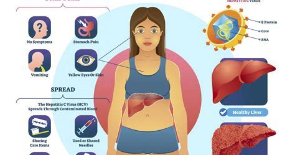 Does Hepatitis Cause Joint Pain?