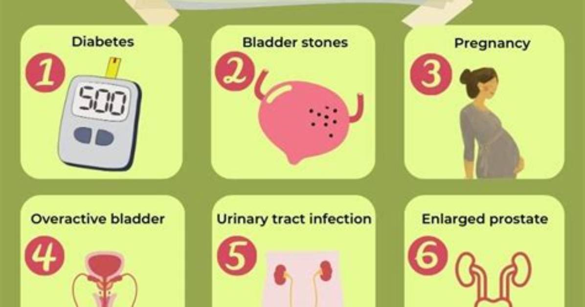 Does Hydronephrosis Cause Frequent Urination?