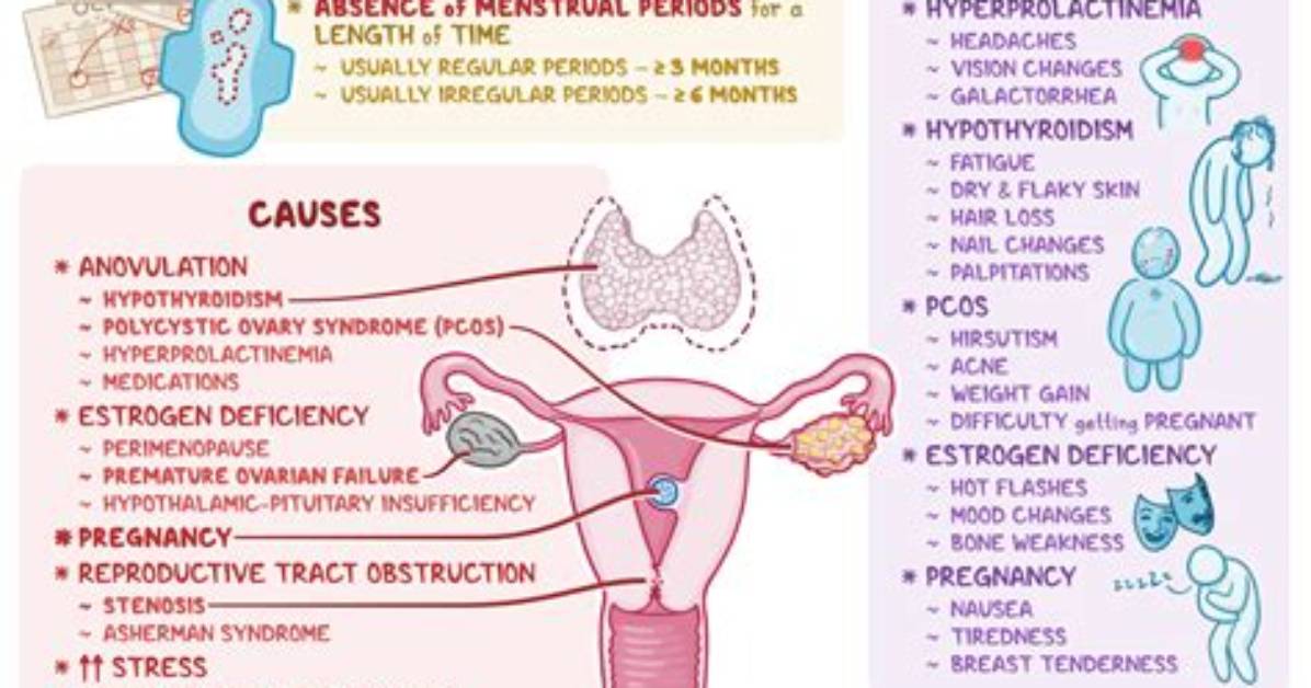 Does Hyperthyroidism Cause Amenorrhea?