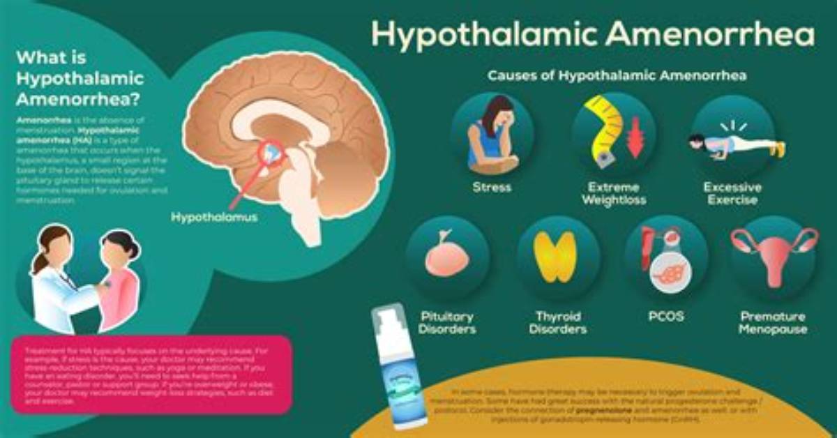 Does Hypothalamic Amenorrhea Cause Infertility?