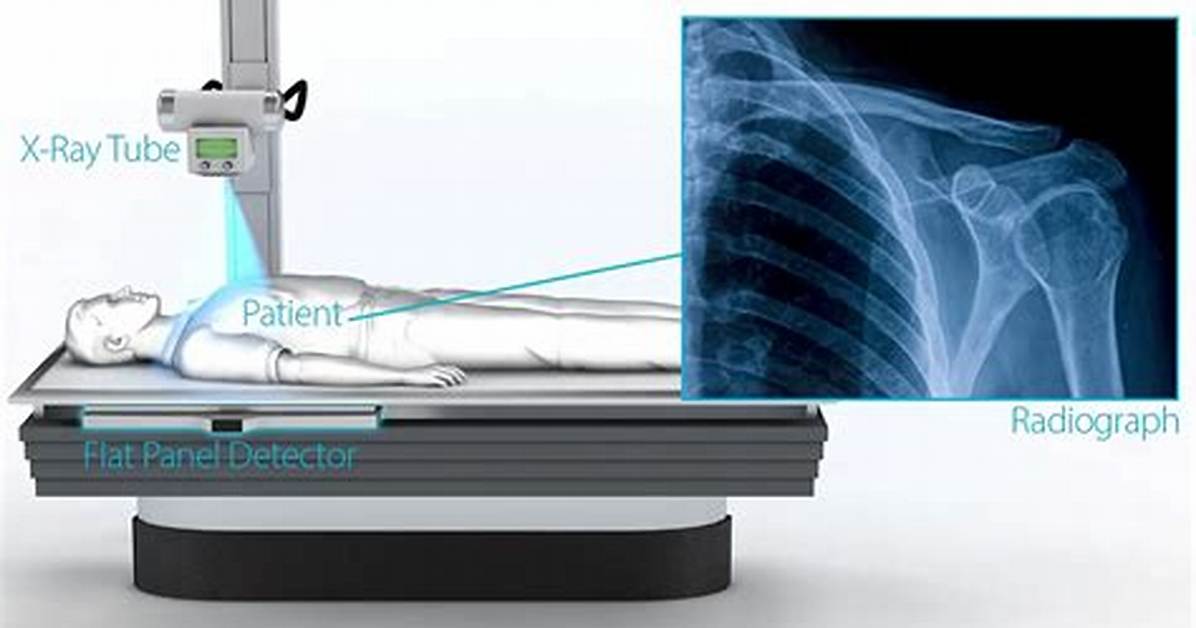 Does Ilkeston Hospital Do X Rays?