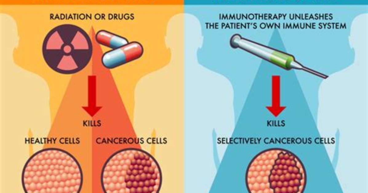 Does Immunotherapy Work for Leiomyosarcoma?