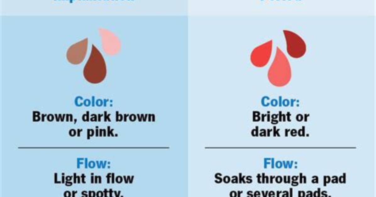 Does Implantation Bleeding Look Stringy?