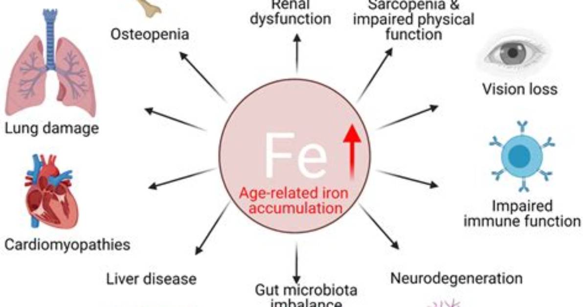 Does Iron Affect Coumadin? | Contextresponse. Com