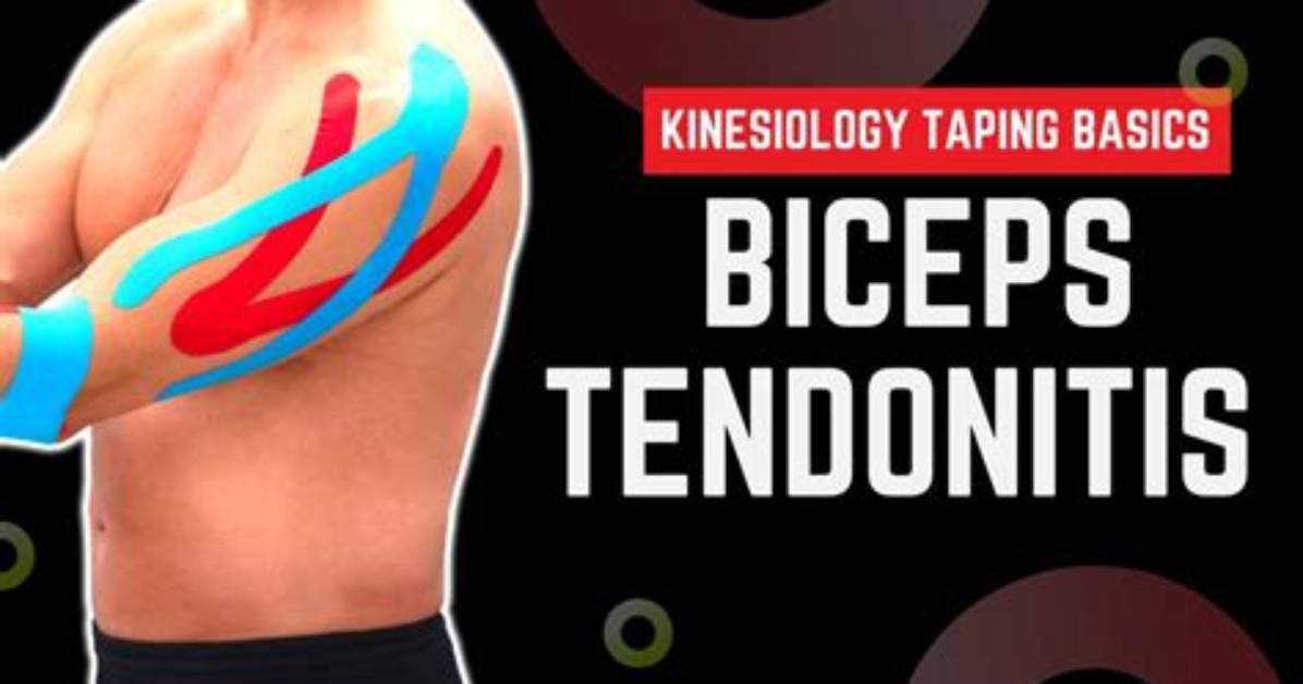 Does Kt Tape Help Bicep Tendonitis