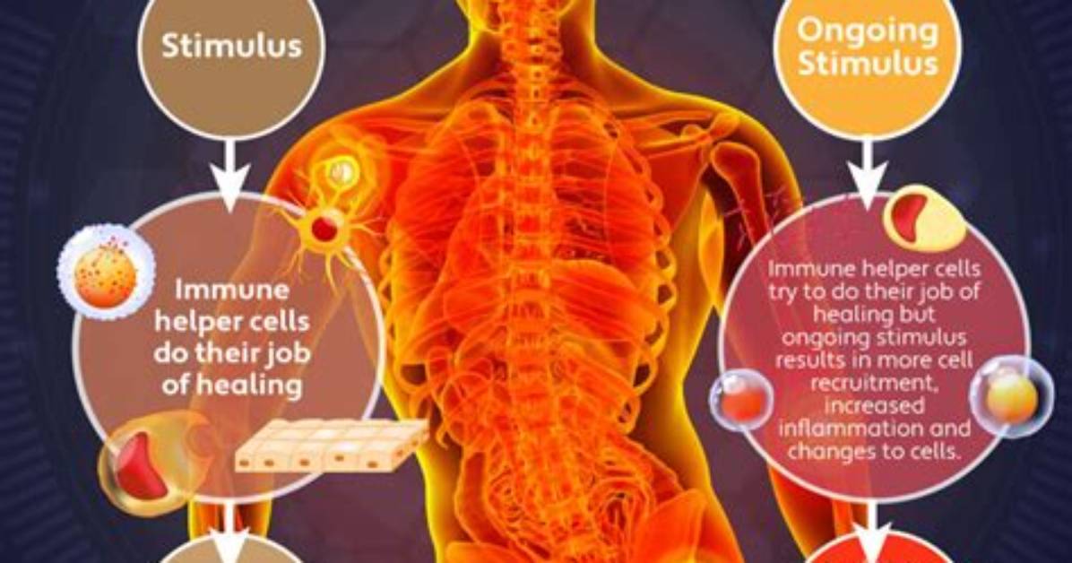 Does Legumes Cause Inflammation?