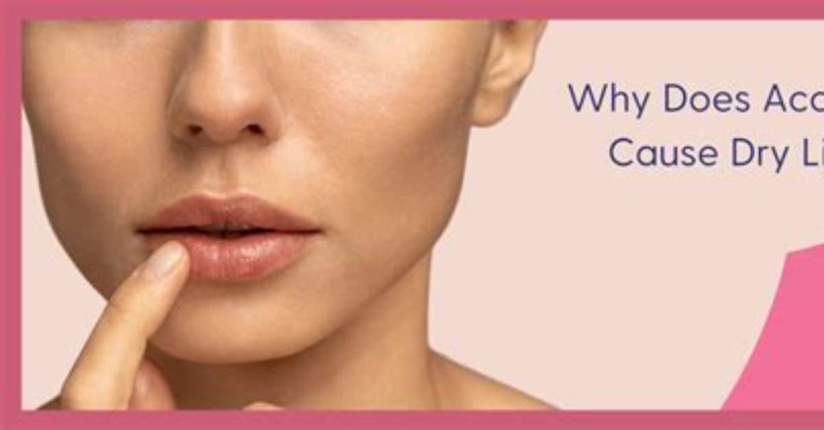 Does Lemon Make Lips Dry?