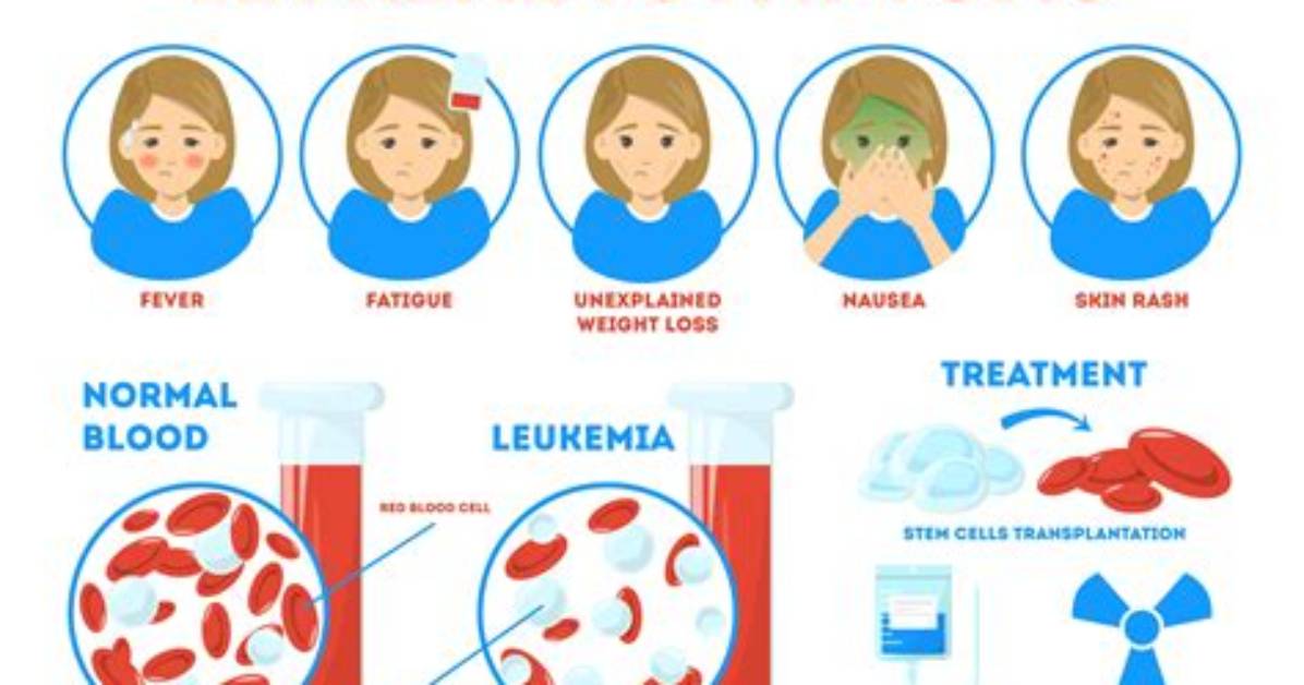 Does Leukemia Have Stages?