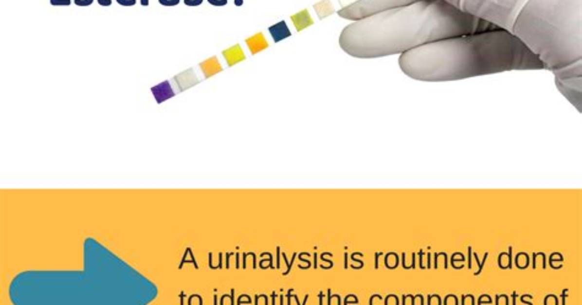 Does Leukocyte Esterase Indicate Lupus?