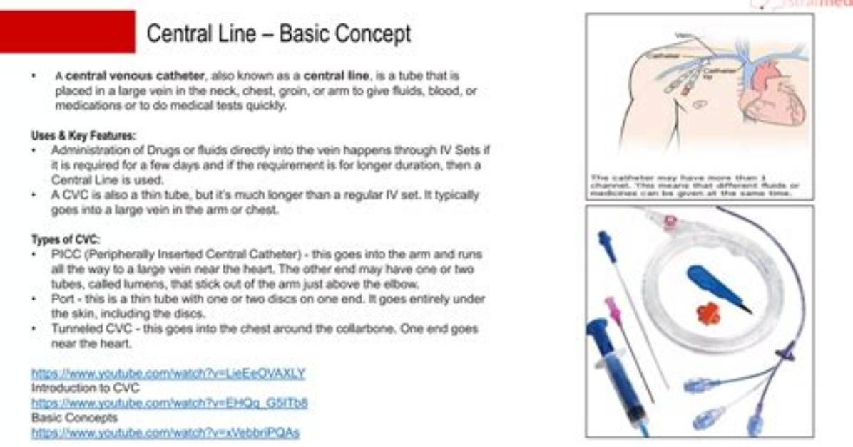 Does Levophed Need a Central Line?