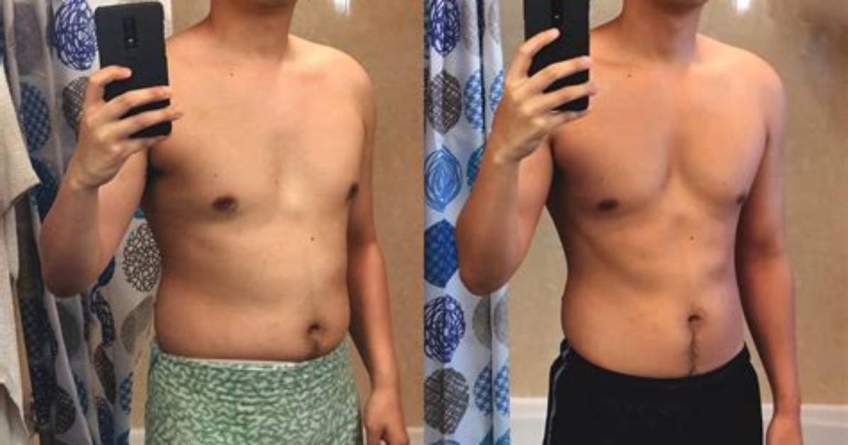 Does Lithium Cause Weight Gain?