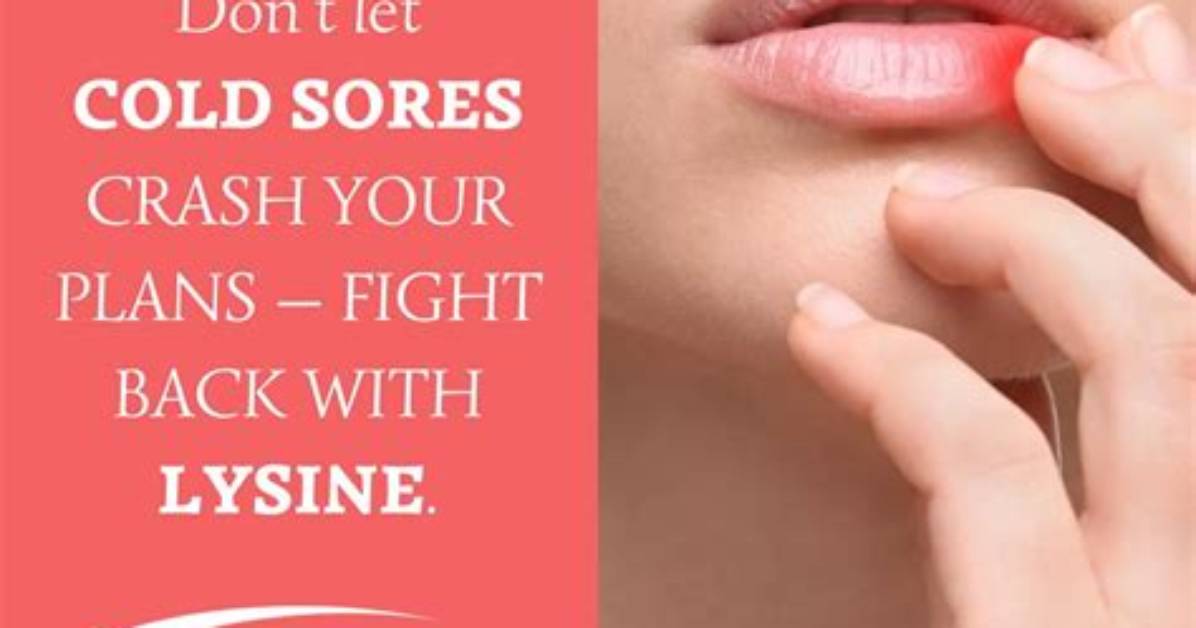 Does Lysine Help with Cold Sores?