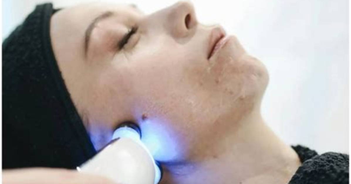 Does Macerated Skin Heal?