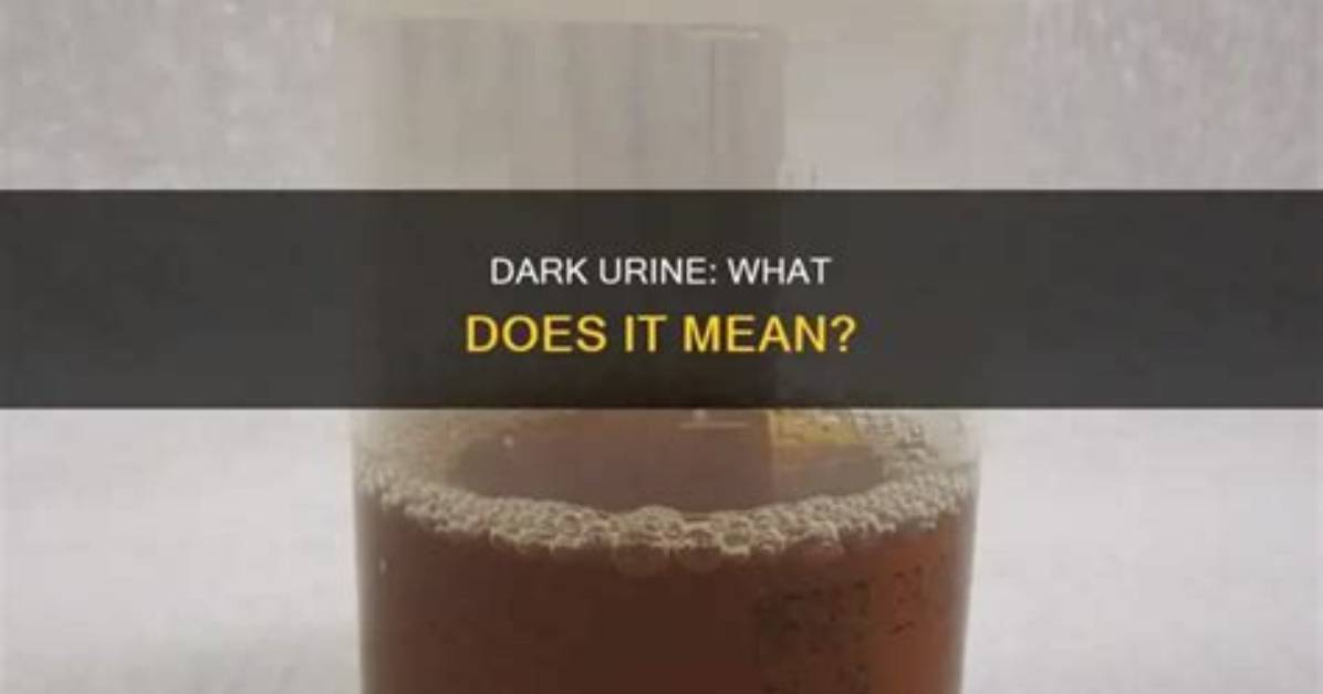 Does Methotrexate Cause Dark Urine