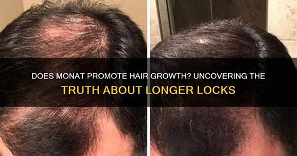 Does Monat Promote Hair Growth