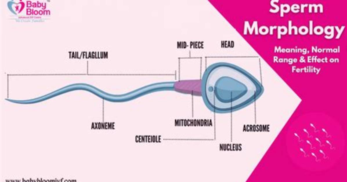 Does Morphology Matter in Ivf?