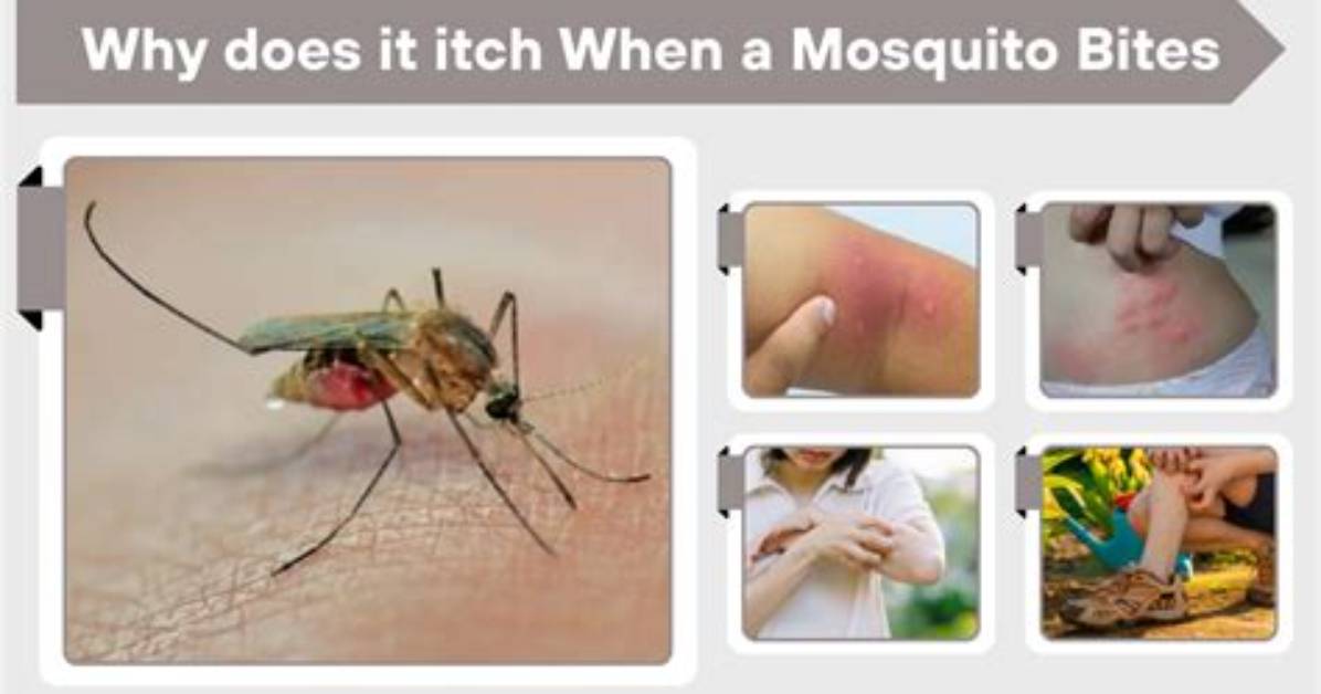 Does Mosquito Bites Itch?