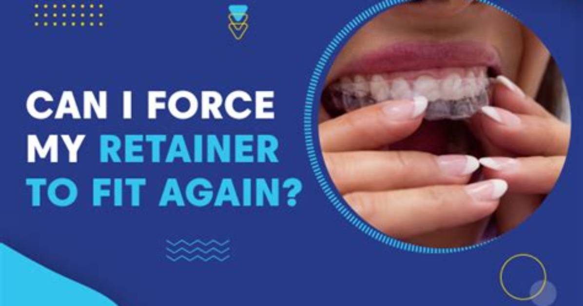 Does My Retainer Fit Properly?