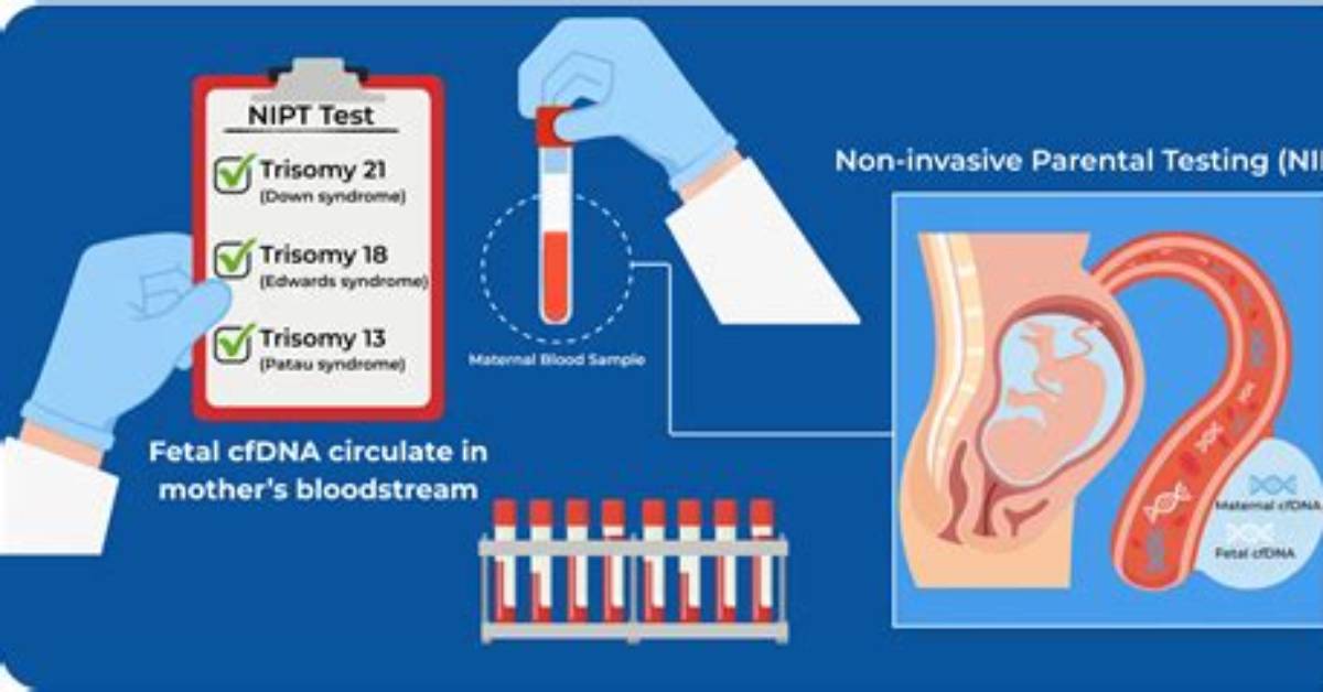 Does Nipt Detect Triploidy?