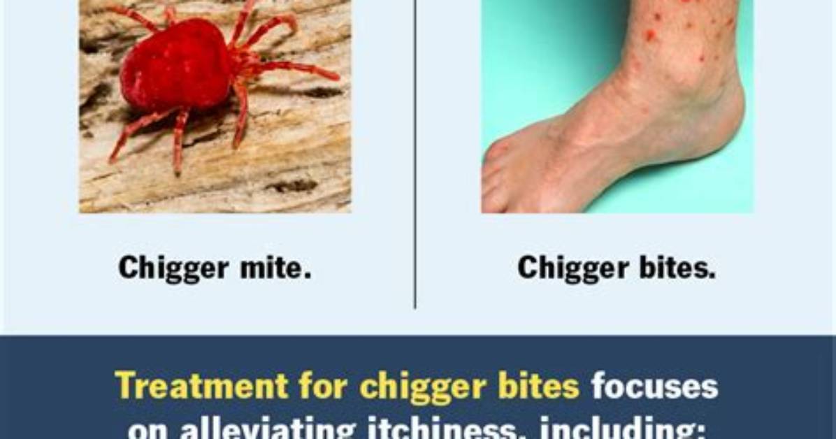 Does off Stop Chiggers?