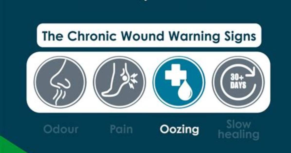 Does Oozing Mean Healing?