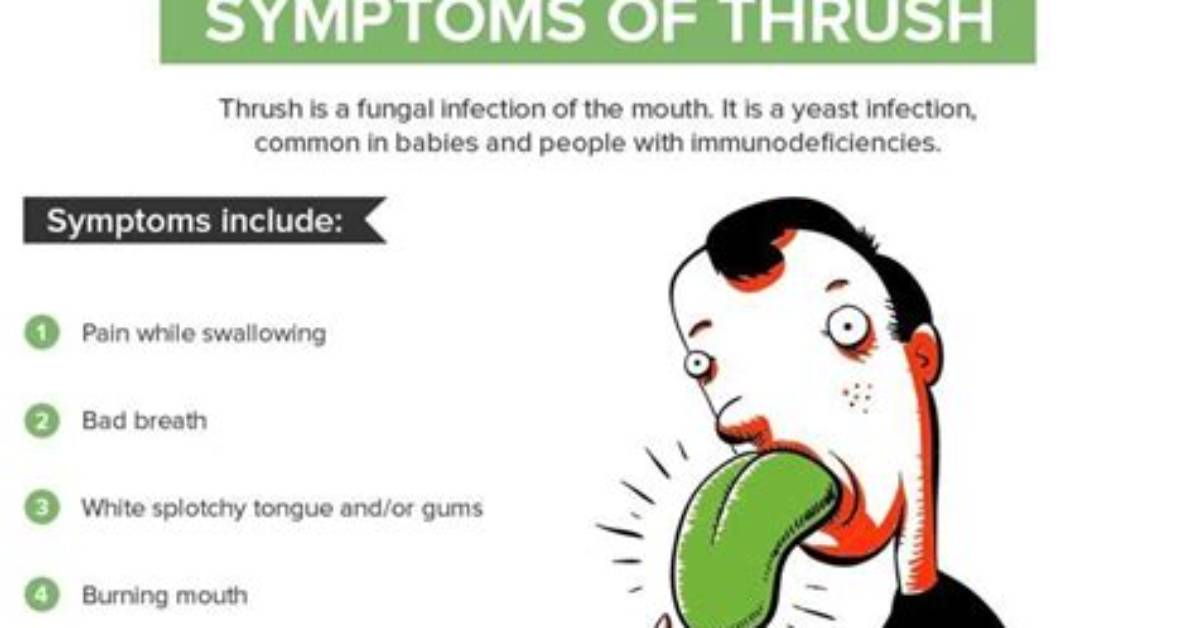 Does Oral Thrush Cause Bad Breath?