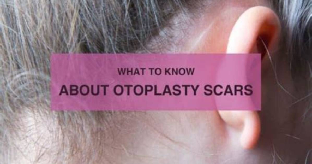 Does Otoplasty Leave Scars?