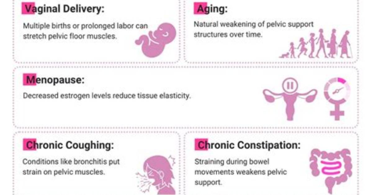 Does Pessary Help Rectocele?