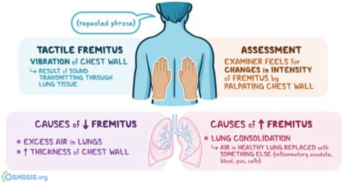 Does Pleural Effusion Increased Tactile Fremitus?