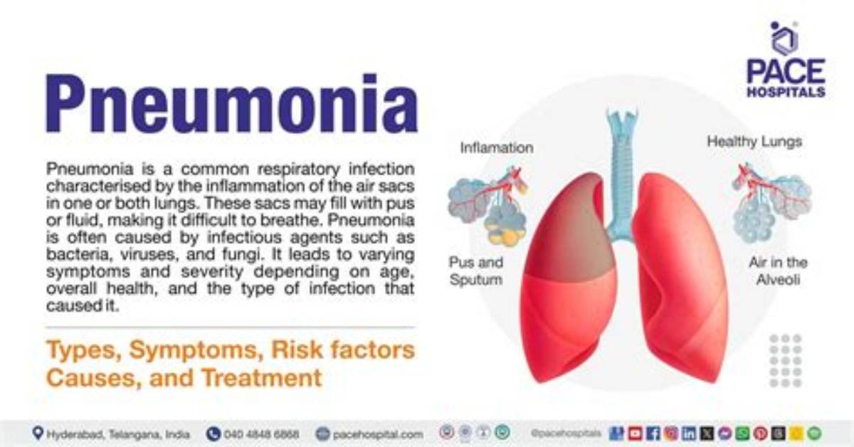 Does Pneumonitis Cause Fever?