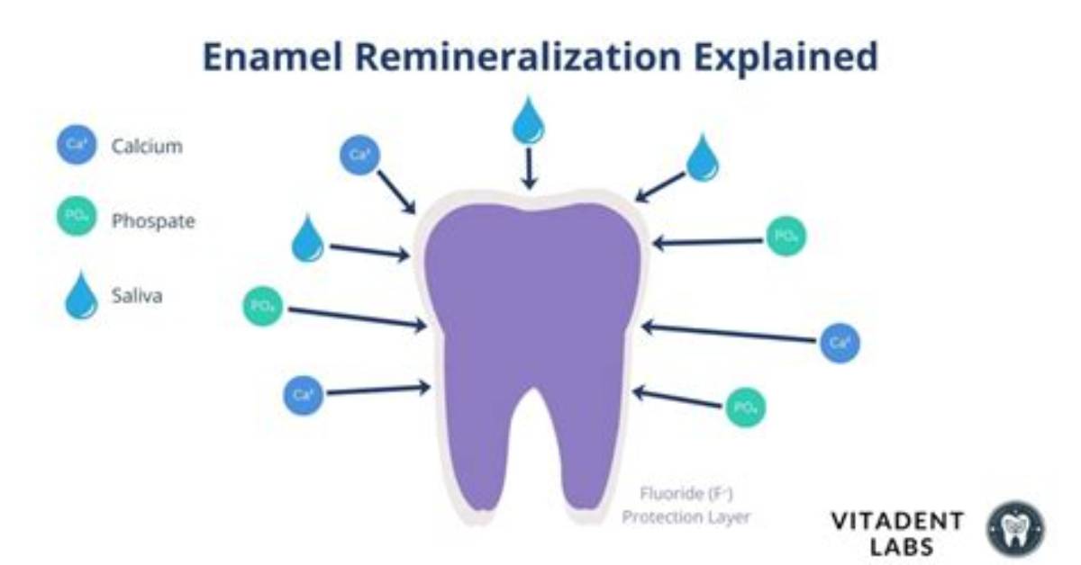 Does Pronamel Really Rebuild Enamel?